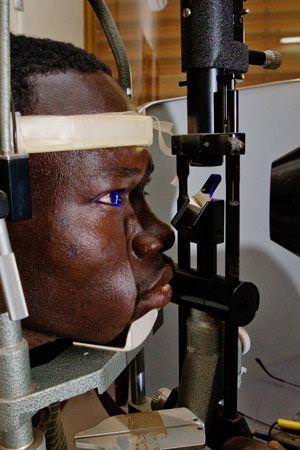 lunettes soinsafrique mars2014